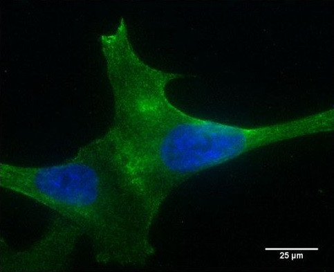 Anti-PLA2R, clone 12-6-5