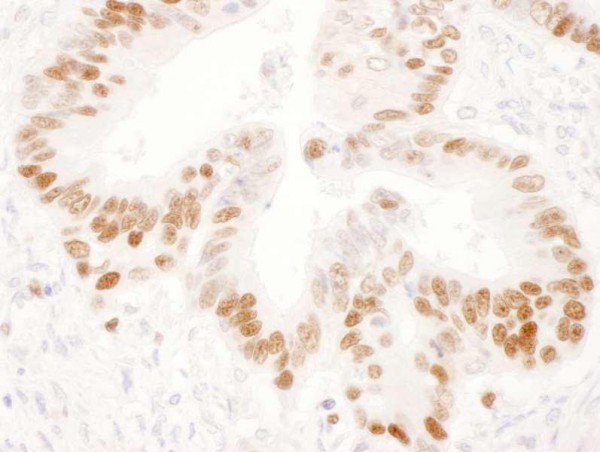 Anti-Mouse IgG-heavy and light chain, HRP conjugated