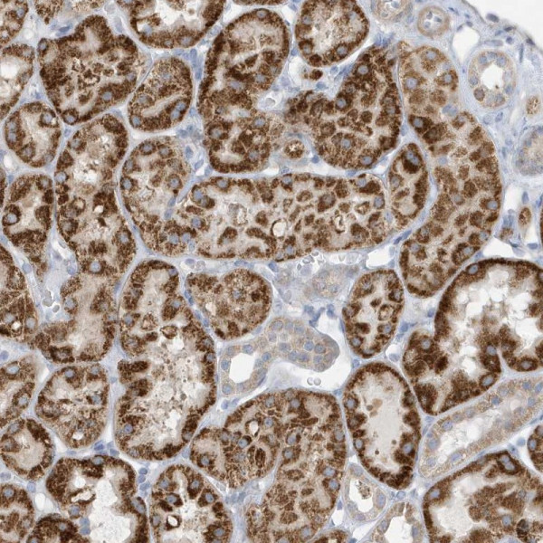 Anti-ATP13A5