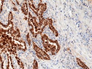 Anti-Surfactant protein B (human), Rabbit Monoclonal (RM370)