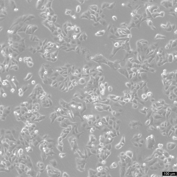 IGROV-1 Cells