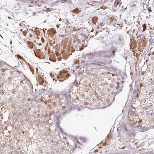 Anti-UTP14C