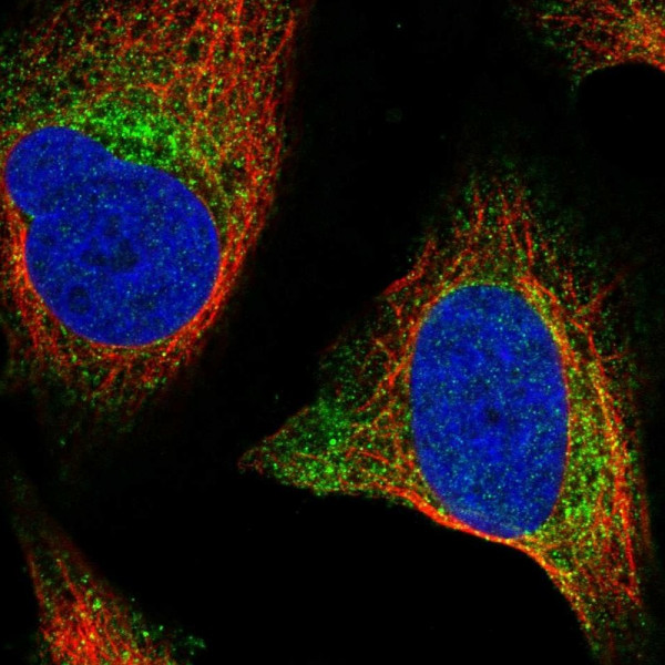 Anti-WNT2B