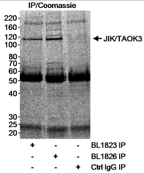 Anti-JIK/TAOK3