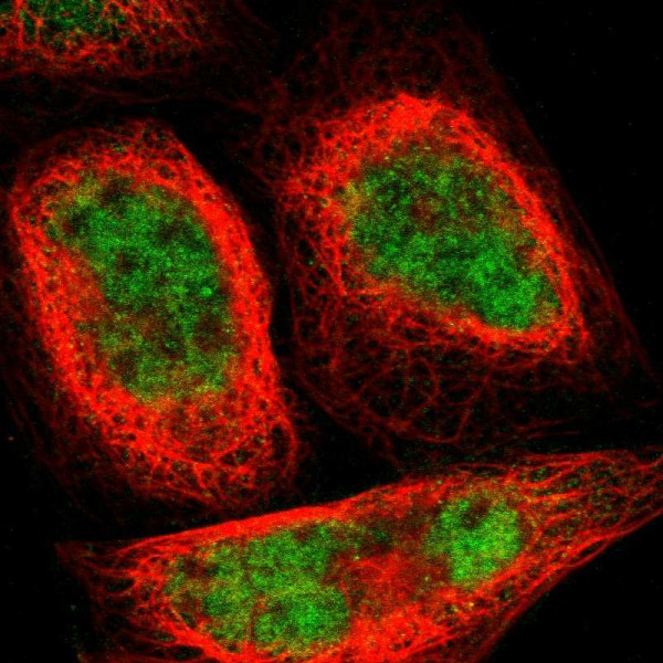Anti-GMEB2