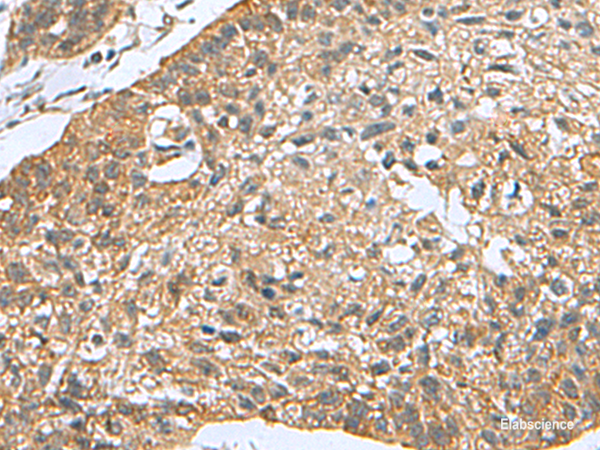 Anti-PDCD5
