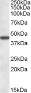 Anti-AADAT, Internal