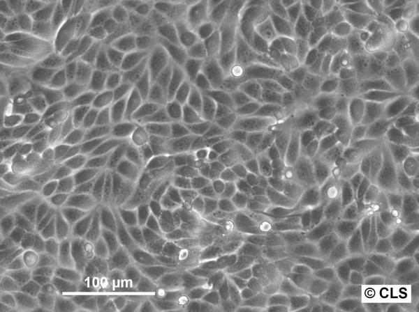 MDCK (NBL-2) Cells