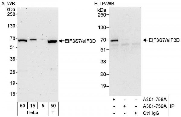 Anti-eIF3D/EIF3S7