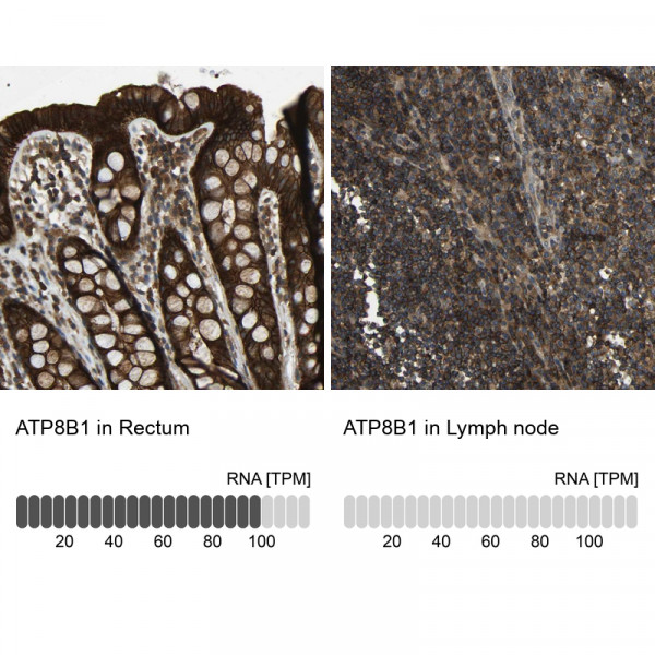 Anti-ATP8B1