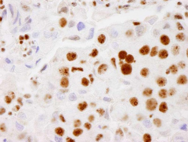 Anti-PELP1/MNAR (IHC)