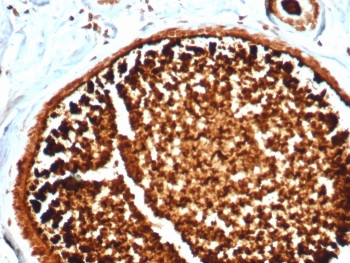 Anti-Mammaglobin A / SCGB2A2, clone MGB/4812R