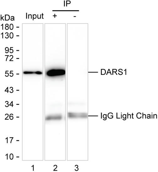 Anti-DARS