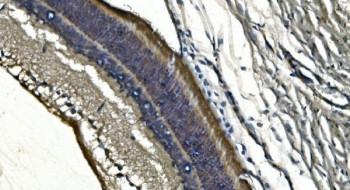 Anti-PDE6 alpha / PDE6A