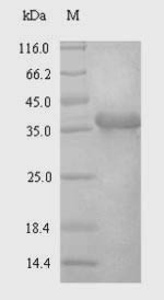 Syndecan-4 (SDC4), partial, human, recombinant