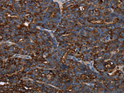 Anti-HMGCL