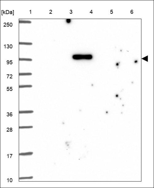 Anti-SLC26A8