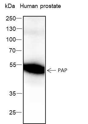 Anti-Recombinant PAP, clone A322