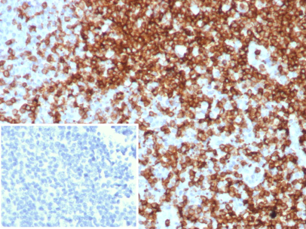 Anti-CD7 (T-Cell Leukemia Marker), recombinant antibody, clone CD7/8496R