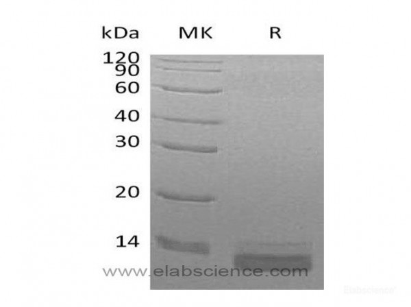 C-C Motif Chemokine 14/CCL14/HCC-3 Protein(C-6His) (recombinant human)