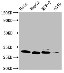 Anti-GSTM3 Monoclonal, clone 1G1F1