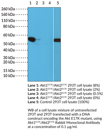 Anti-Akt1E17K/Akt2E17K Rabbit Monoclonal Antibody (Clone RM336)