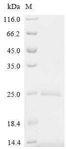 Hemoglobin subunit beta(HBB), Macaca fascicularis, recombinant