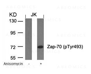 Anti-phospho-Zap-70 (Tyr493)