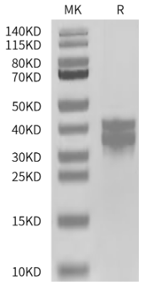 PBK/TOPK, His, Human