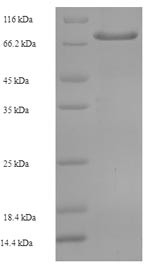 Transmembrane prolyl 4-hydroxylase (P4HTM), partial, human, recombinant