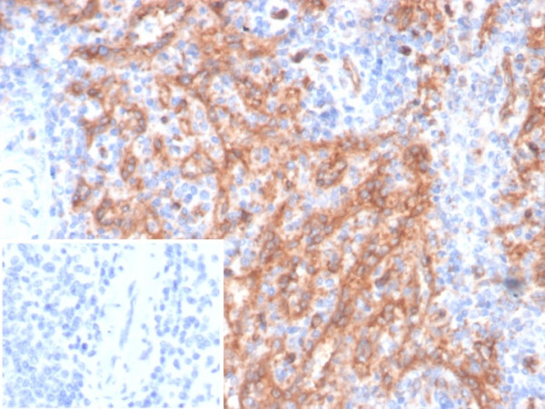 Anti-CD36 (Platelet &amp; Microvessel Marker), clone CD36/7218