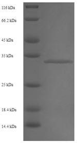 Putative RNA-binding protein 3 (RBM3), human, recombinant