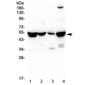 Anti-ASL / Adenylosuccinate Lyase