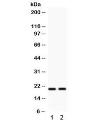 Anti-HSPB2