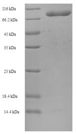 T-complex protein 1 subunit beta (CCT2), human, recombinant