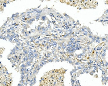 Anti-EDNRA / Endothelin A Receptor