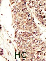 Anti-IGF-1 Receptor