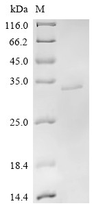 Chymotrypsin-like protease VLCTLP, Macrovipera lebetina, recombinant