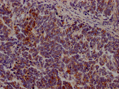 Anti-JAK3 Recombinant Monoclonal, clone 1C7