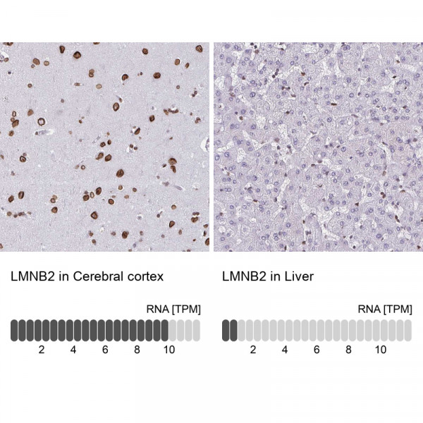 Anti-LMNB2