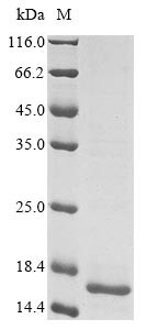 Spike glycoprotein (S), partial, human coronavirus 229E, recombinant