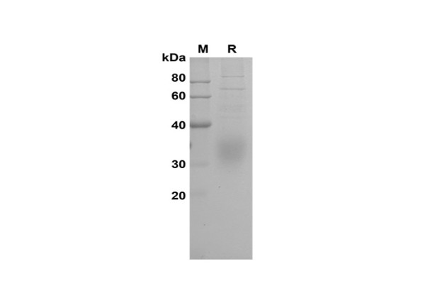 Recombinant Human RNAS2 Protein