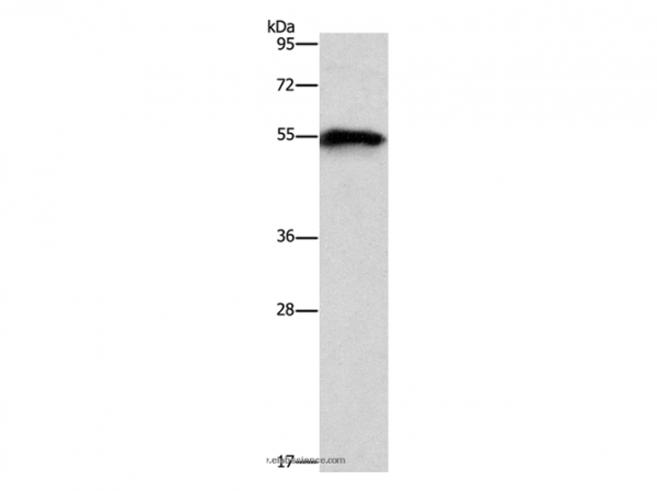 Anti-CDK19