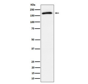 Anti-phospho-AS160 (Thr642) / TBC1D4, clone 31T47