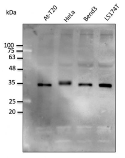 Anti-STUB1 / CHIP