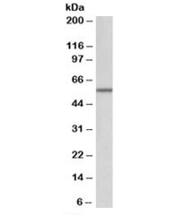 Anti-ALDH6A1