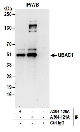 Anti-UBAC1