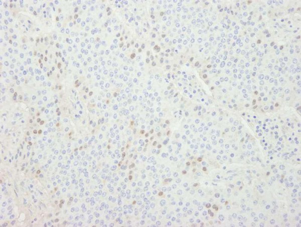 Anti-CDT1 (IHC)