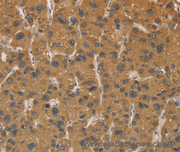 Anti-CYP17A1