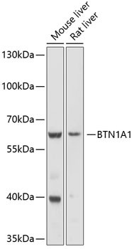 Anti-BTN1A1
